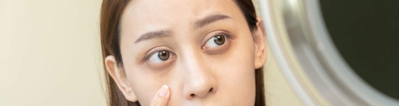 Dark Circles Under Eyes? Here’s How to Get Rid of Them...