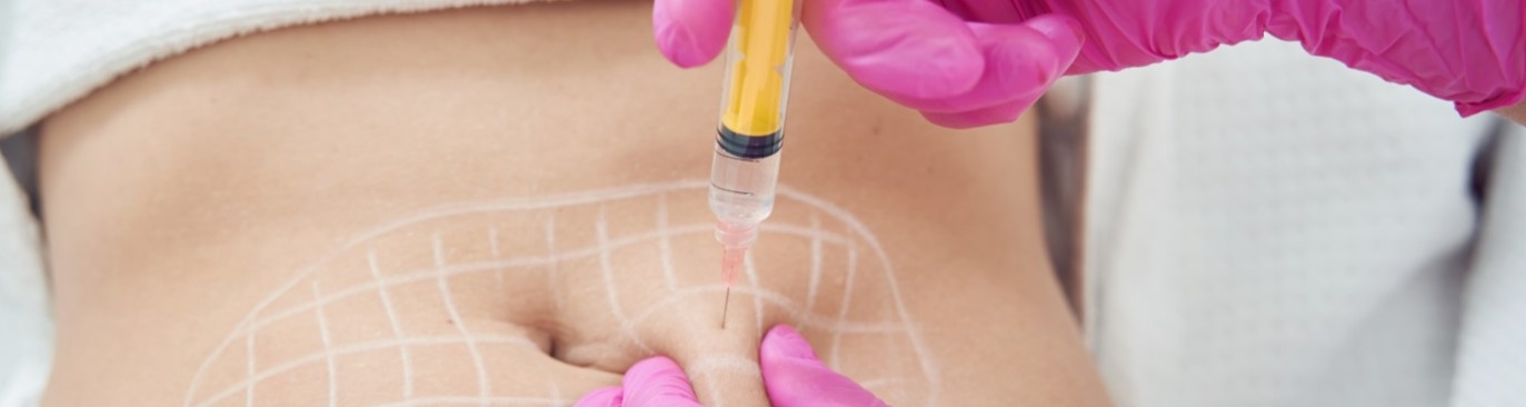 Fat Dissolving Injections