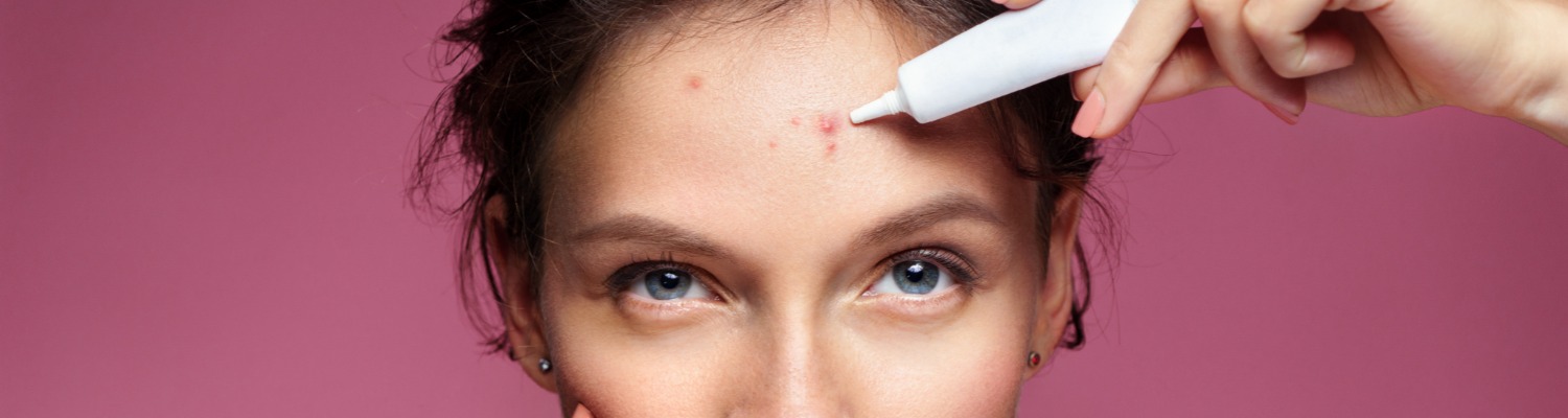 How Can I Use Skincare to Manage Breakouts?