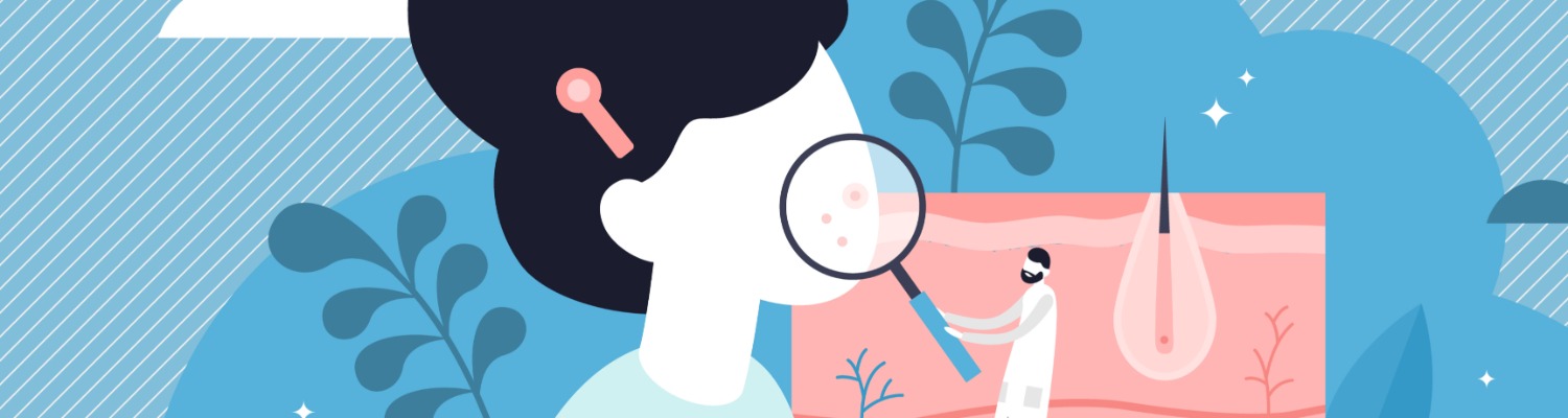 How Do Hormones Affect Your Skin?