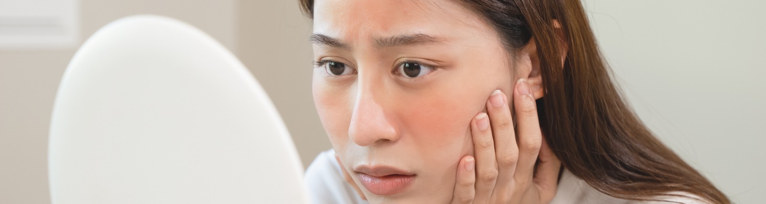 How to manage your rosacea for healthier looking skin