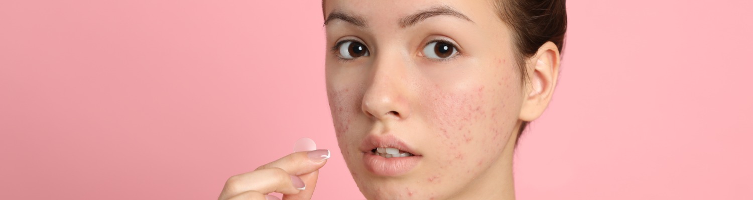 Is This the Best At-Home Treatment for Acne Scarring?