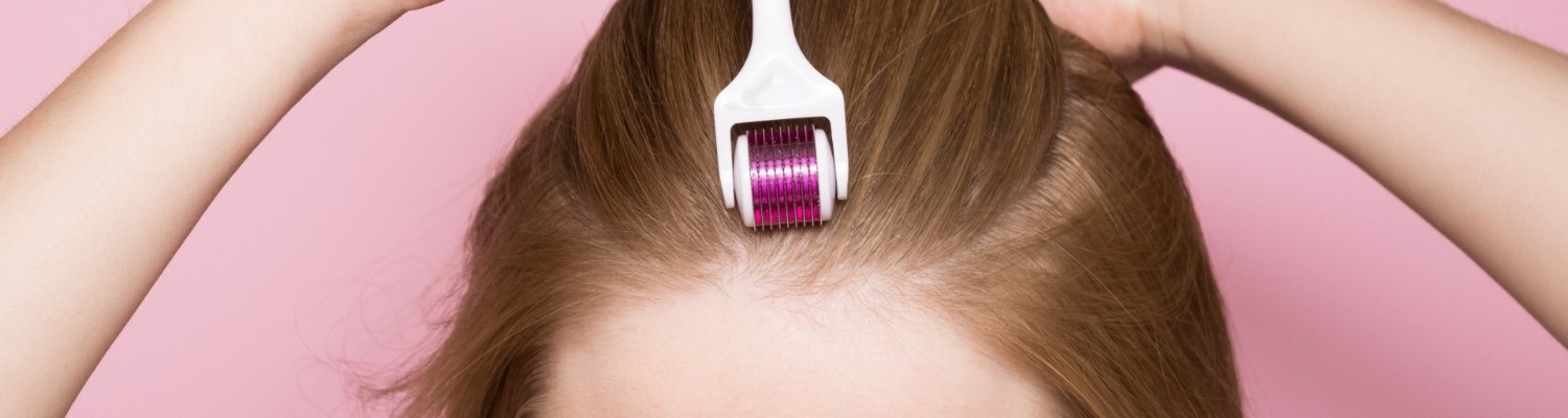 Mesotherapy for Hair Loss and Scalp Seborrhoea