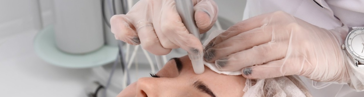 Milia Treatment With Electrolysis