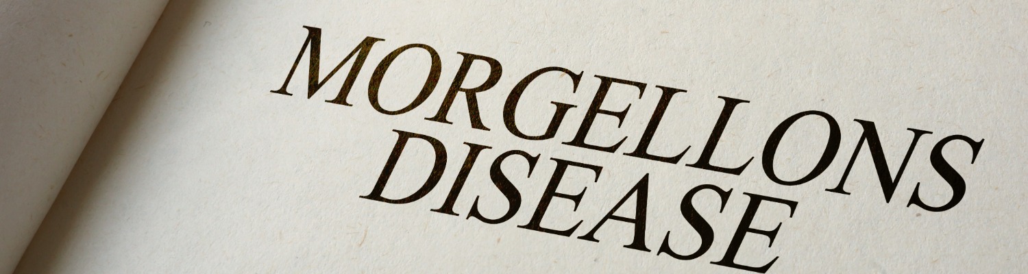 Morgellons: Is the Mystery Condition Solved at Last?