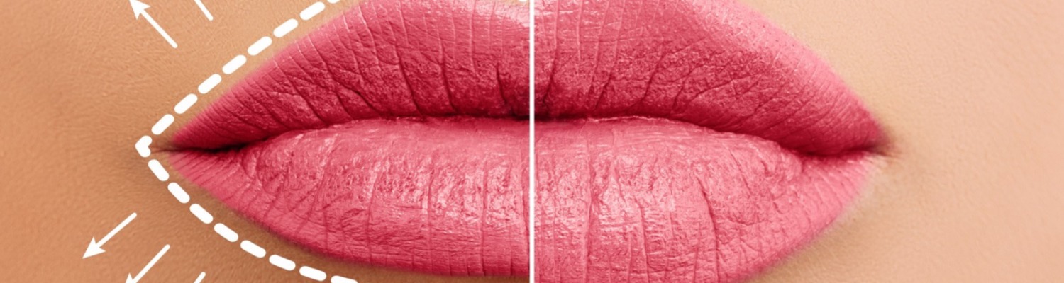 Should Beauty Therapists Be Performing Injection Treatments?