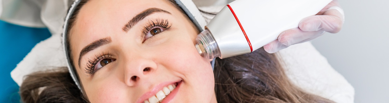 The Benefits of Microneedling