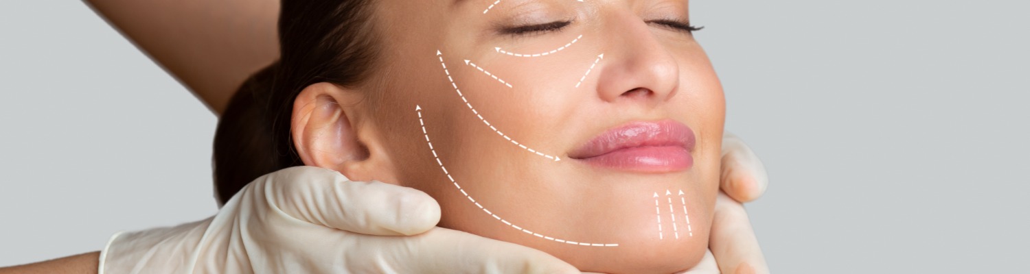 What Is Radiesse Filler?