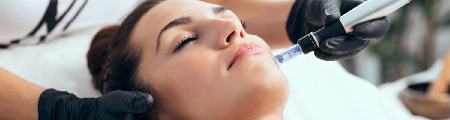 Why I’m Obsessed With Skinpen Micro-Needling
