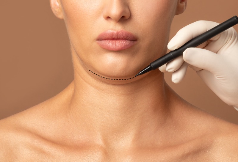 Can a Double Chin Be Reduced?