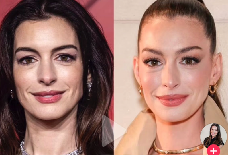 Did Anne Hathaway Really Have a Facelift? Experts Reveal the Subtle Signs You Might've Missed