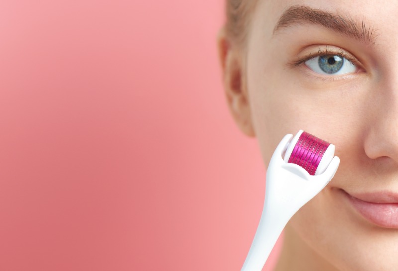 Everything You Need to Know About Microneedling