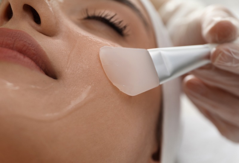 Give Your Skin a Boost With a Chemical Peel