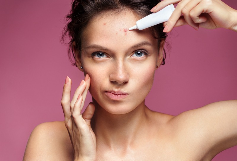 How Can I Use Skincare to Manage Breakouts?