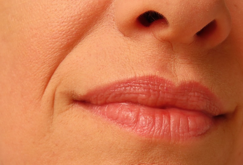 How to Remove Smokers Lines