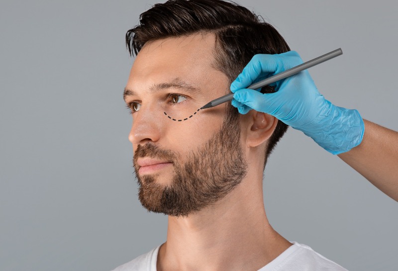 Is a €600 Eye Lift Too Good to Be True?