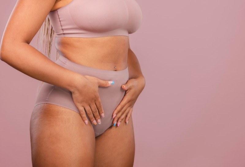 PCOS: Why Diet Matters!