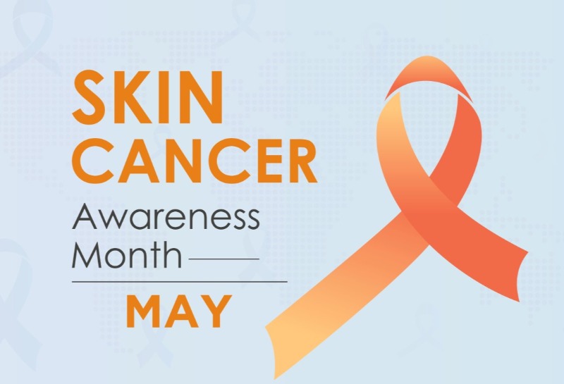 Skin Cancer Awareness Month - Checking Your Moles