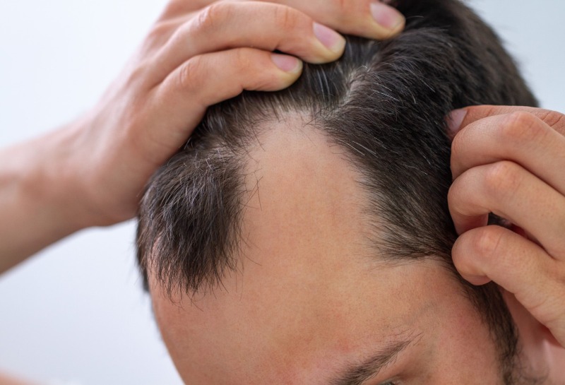 The Significance of Hair: Why It Is Ok for Men to Care Too