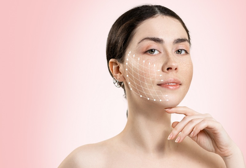 What Are Thread Lifts?