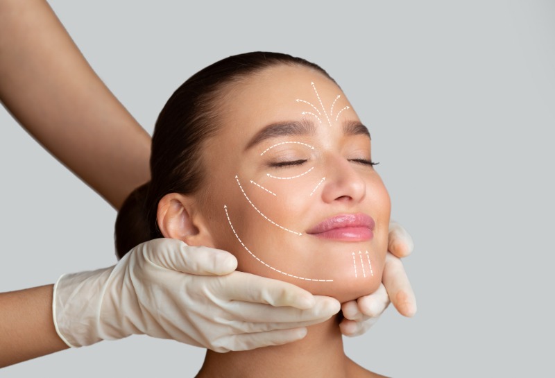 What Is Radiesse Filler?