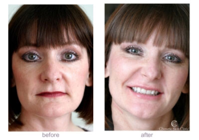 Cosmetic Skin Clinic at Rogers Lane Right Banner