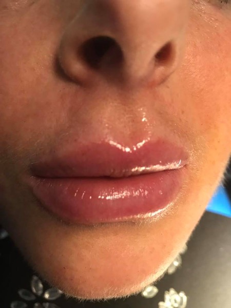 Lips