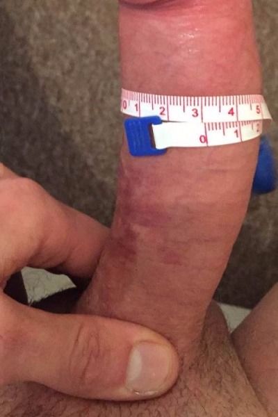 Patient C After