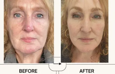 Before and after skin rejuvenation treatment
