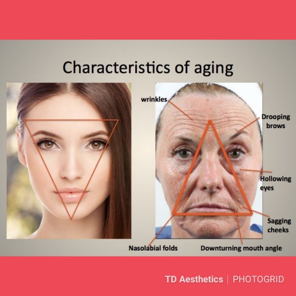 Characteristics of ageing