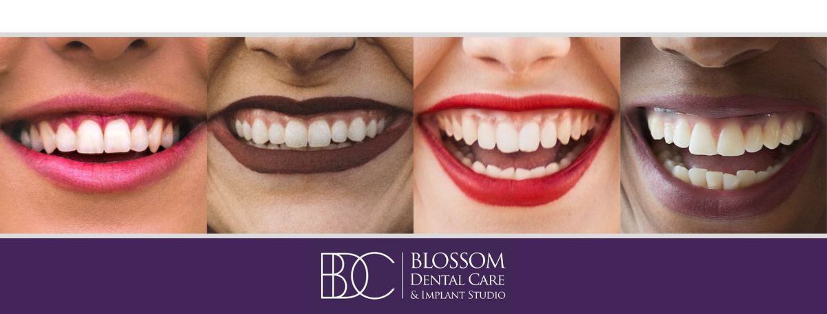 Blossom Dental Care and Implant Studio Banner