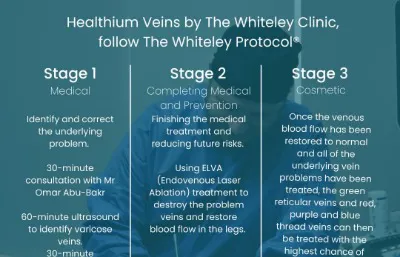 Varicose Vein treatment Information