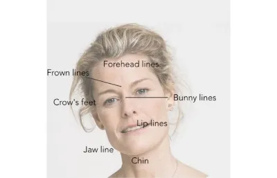 Anti-wrinkle treatment Treatments at Dr Home Aesthetics