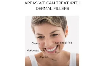 Dermal filler treatment
