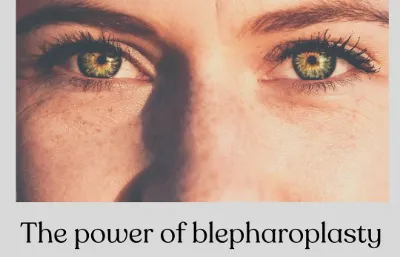 Blepharoplasty treatment