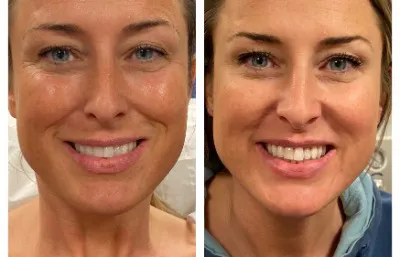 antiaging package