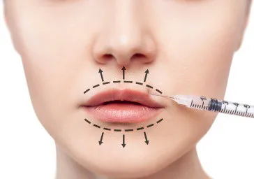 Lip Volumising and Shaping