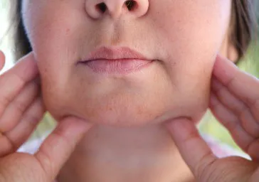 Facial Skin Tightening, Sagging Skin and Jowls
