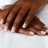 Hand Rejuvenation
