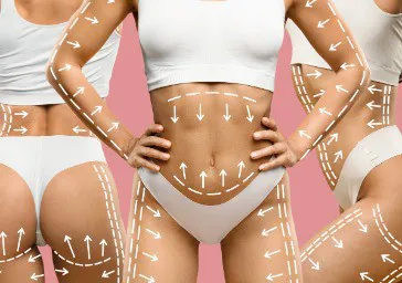 Body Contouring
