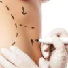 Body Contouring