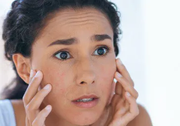 Complexion Improvement, Skin Texture Concerns