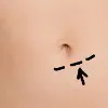 Belly Button Shape