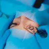 Vision Correction With Laser Eye Surgery