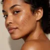 Hyperpigmentation