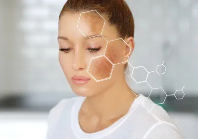 Hyperpigmentation? Image