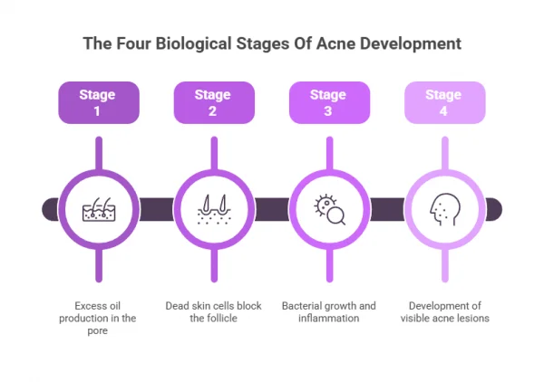 The Four Biological Stages Of Acne Development