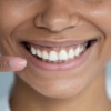 Teeth - Cosmetic Dentistry 