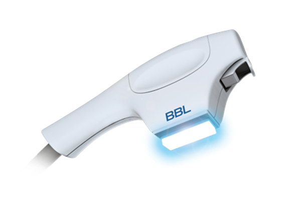 IPL Treatment (BBL® HERO™) in Bellingham, Burlington & Bothell