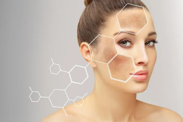 Skin Discolouration
